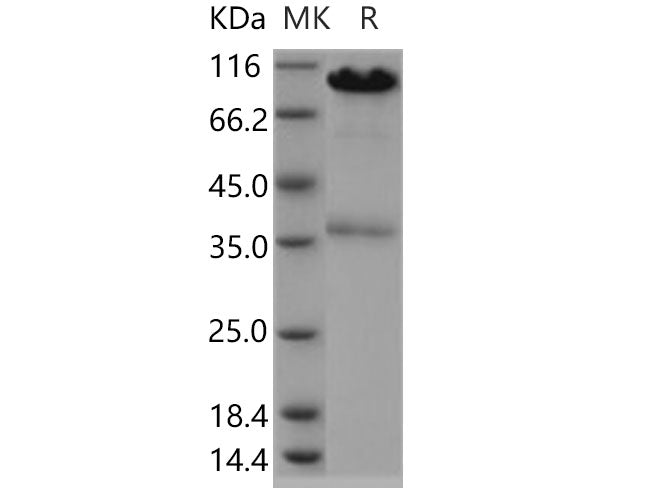 Recombinant Human CALR/Calreticulin Protein (Fc Tag)