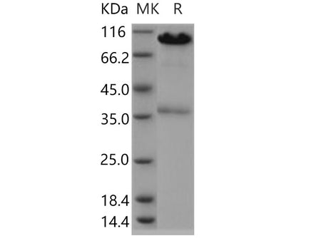 Recombinant Human CALR/Calreticulin Protein (Fc Tag)