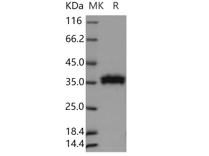 Recombinant Human RNASET2 Protein (Baculovirus, His Tag)