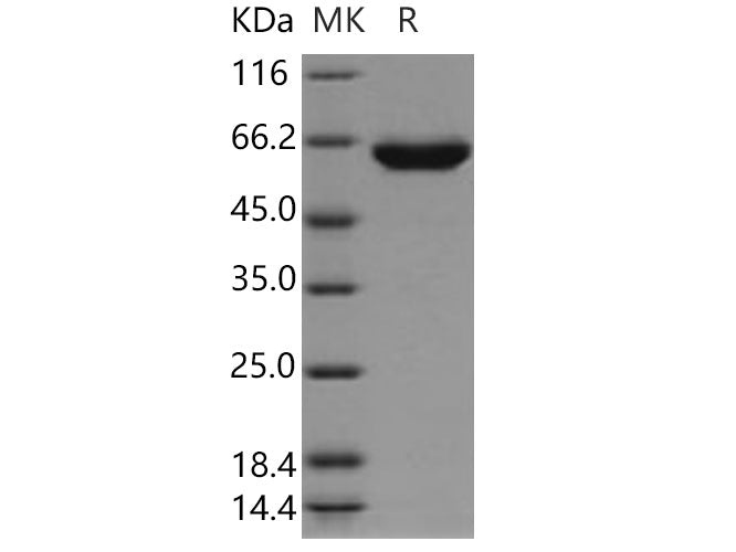 Recombinant Human TPP1/CLN2 Protein (His Tag)(Active)