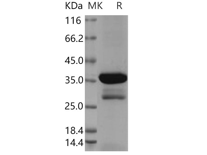 Recombinant Human DCX Protein (aa 45-150, GST Tag)