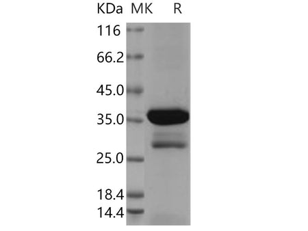 Recombinant Human DCX Protein (aa 45-150, GST Tag)