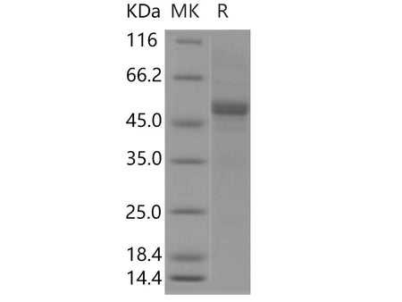 Recombinant Human APOM Protein (Fc Tag)