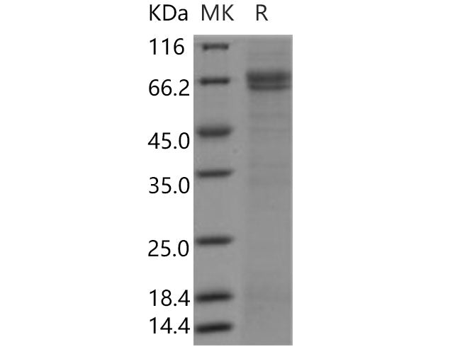 Recombinant Human SUSD4/Sushi domain-containing protein 4 Protein (Fc Tag)