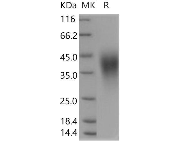 Recombinant Human B7-H5/Gi24/VSIR Protein (His tag)