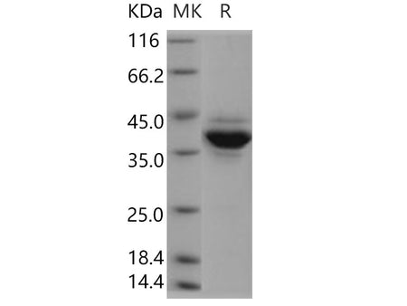 Recombinant Human Jumping Translocation Breakpoint/JTB Protein (Fc Tag)