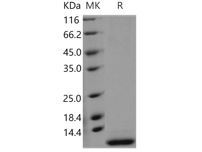 Recombinant Human SMR3B Protein (His Tag)