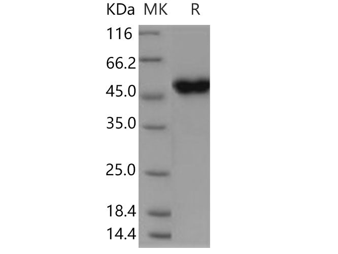 Recombinant Human CRELD1 Protein (His Tag)