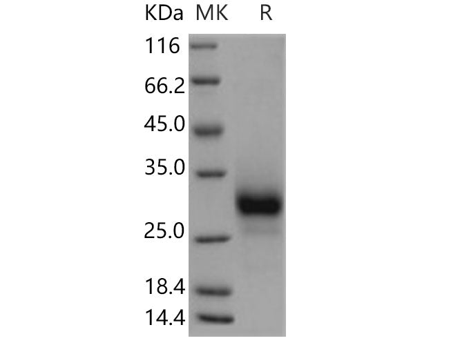 Recombinant Human TNFRSF19/TROY Protein (His Tag)