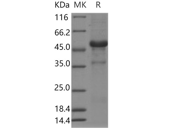 Recombinant Human LECT1 Protein (Fc Tag)