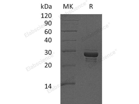 Recombinant Human CALCB Protein (aa 1-118, Fc Tag)