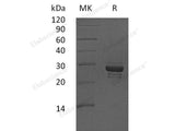 Recombinant Human CALCB Protein (aa 1-118, Fc Tag)