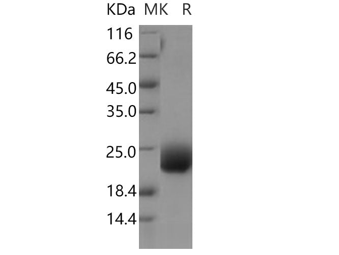 Recombinant Human CCDC47 Protein (His Tag)