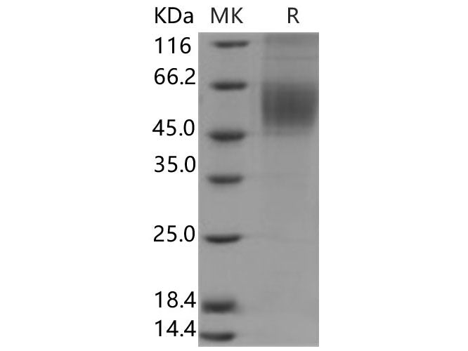 Recombinant Human CDCP1/CD318 Protein (aa 1-343, His Tag)