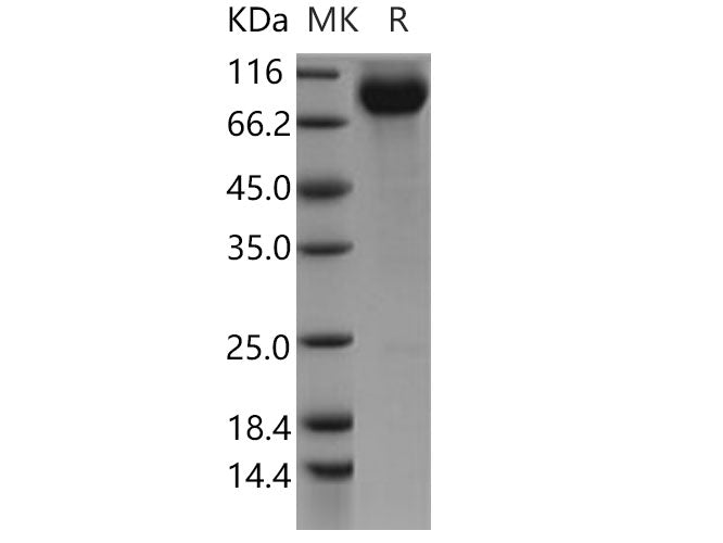 Recombinant Human CDCP1/CD318 Protein (Fc Tag)