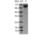 Recombinant Human CDCP1/CD318 Protein (Fc Tag)