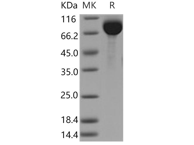 Recombinant Human AFM/Afamin Protein (His Tag)