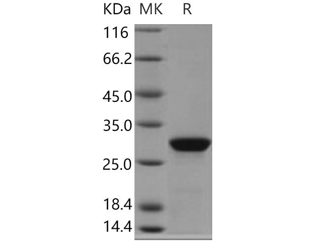 Recombinant Human Parathyroid Hormone/PTH Protein (aa 32-65, GST Tag)