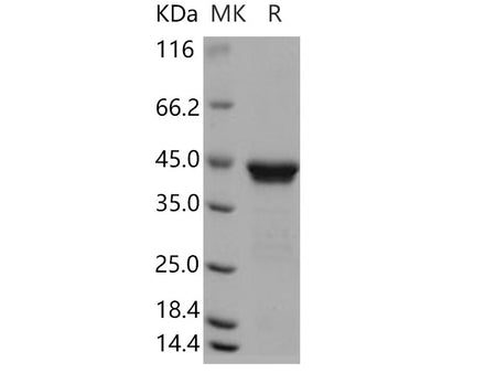 Recombinant Human RRM2B/P53R2 Protein (His Tag)