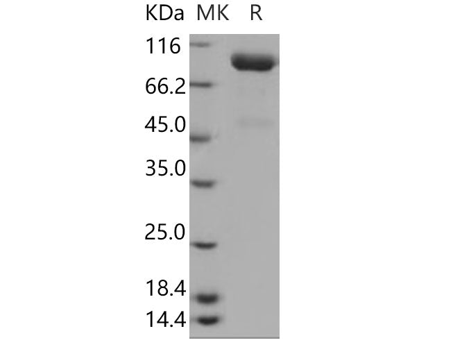 Recombinant Human SLITRK4 Protein (His Tag)