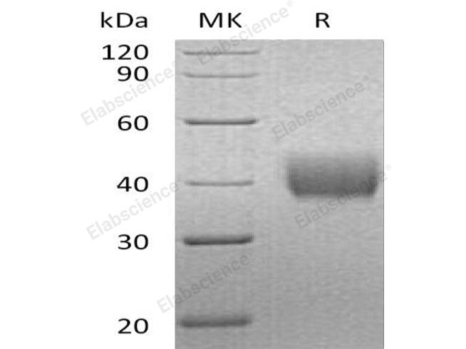 Recombinant Human Mesothelin/MSLN Protein (His Tag)