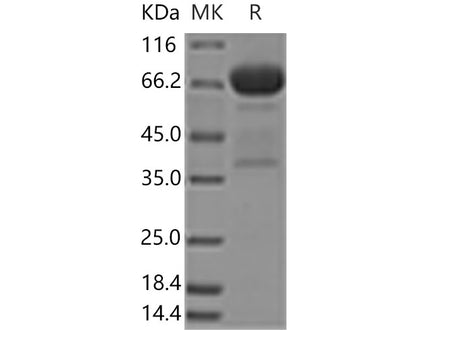 Recombinant Human Mesothelin/MSLN Protein (aa 296-580, Fc Tag)