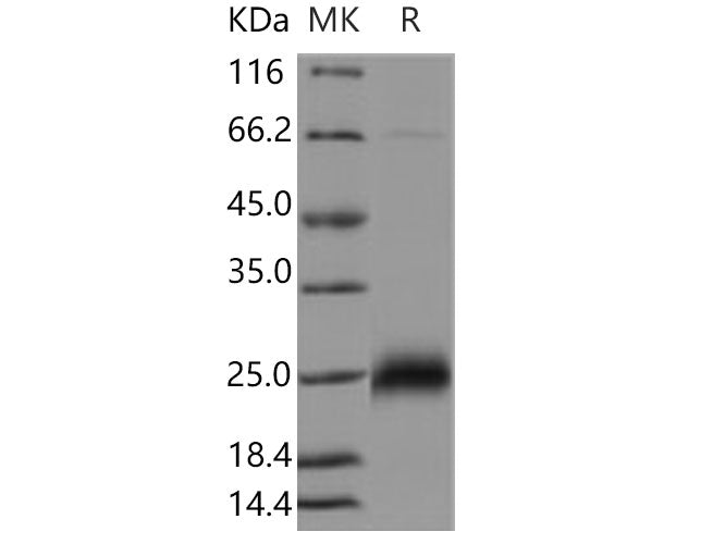 Recombinant Human CGB7 Protein (His Tag)