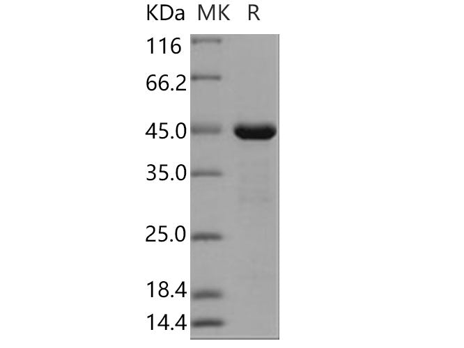 Recombinant Human PRL-2/PTP4A2 Protein (GST Tag)