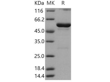 Recombinant Human HNMT Protein (GST Tag)