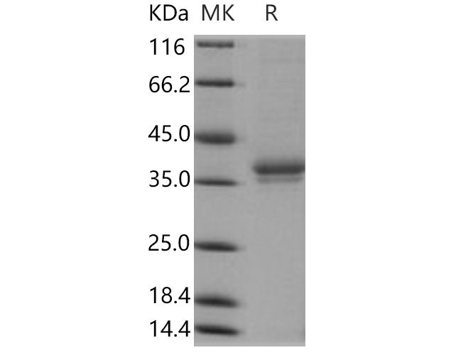 Recombinant Human IGSF11/BTIGSF Protein (His Tag)