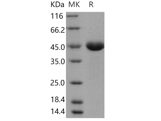 Recombinant Human PGA4/Pepsinogen A Protein (His Tag)(Active)