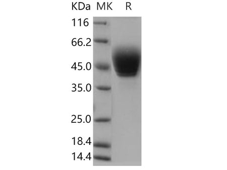Recombinant Human TSPAN1 Protein (aa 110-211, Fc Tag)