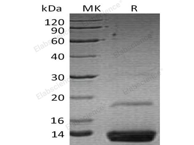 Recombinant Human Resistin Protein (aa 17-108, Fc Tag)