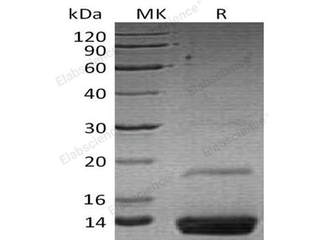 Recombinant Human Resistin Protein (aa 17-108, Fc Tag)