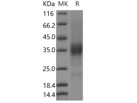 Recombinant Human KIR2DL4/CD158D Protein