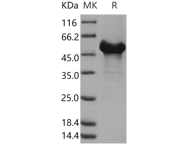 Recombinant Human RTN4/NOGO-A Protein (GST Tag)