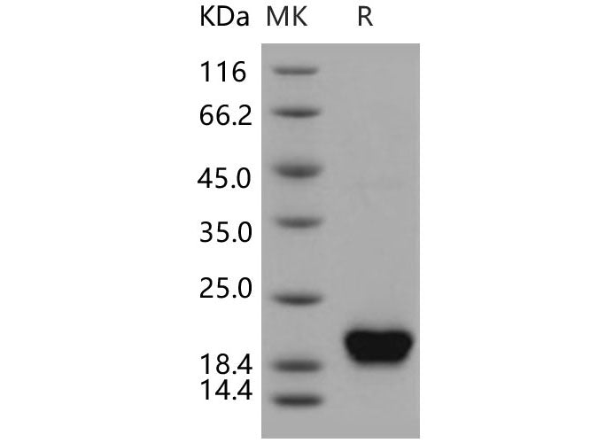 Recombinant Human NUDT2/Ap4A hydrolase Protein (His Tag)