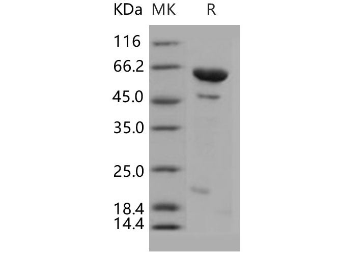 Recombinant Human DUSP14/MKP-6 Protein (His & MBP Tag)