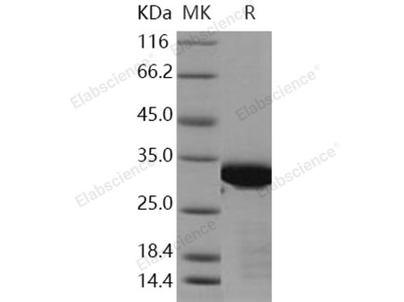 Recombinant Human BCL6/B-cell CLL lymphoma 6 Protein (aa 1-150, His & Trx Tag)