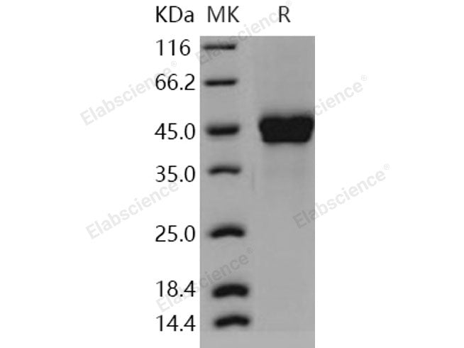 Recombinant Human PTX3/Pentraxin 3/TSG-14 Protein (His Tag)