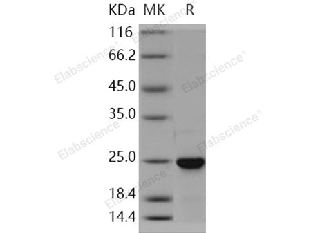 Recombinant Human NRAS Protein (His Tag)