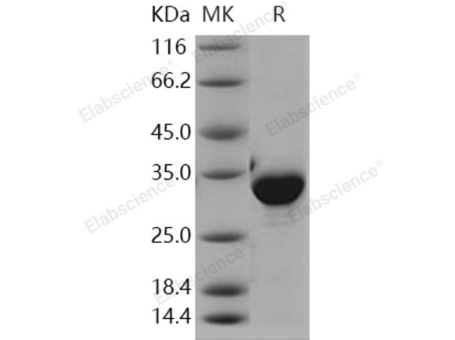 Recombinant Human NQO1/DT-diaphorase Protein (His Tag)