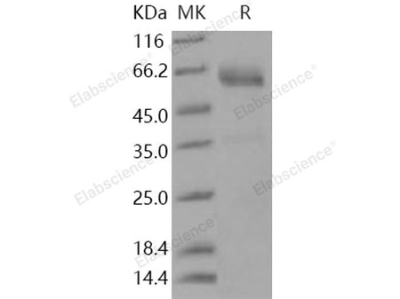 Recombinant Human SMOC1 Protein (His Tag)