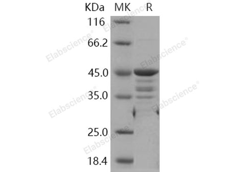 Recombinant Human WTAP Protein (GST Tag)