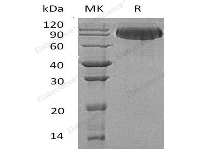 Recombinant Human Butyrylcholinesterase/BCHE Protein (His Tag)(Active)