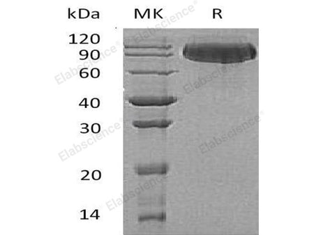 Recombinant Human Butyrylcholinesterase/BCHE Protein (His Tag)(Active)