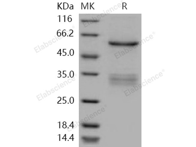Recombinant Human SUV420H2 Protein (His & GST Tag)
