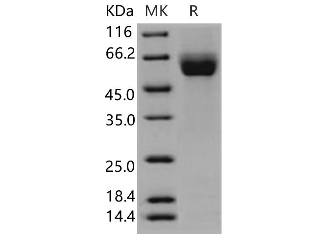 Recombinant Human ROBO4 Protein (His Tag)