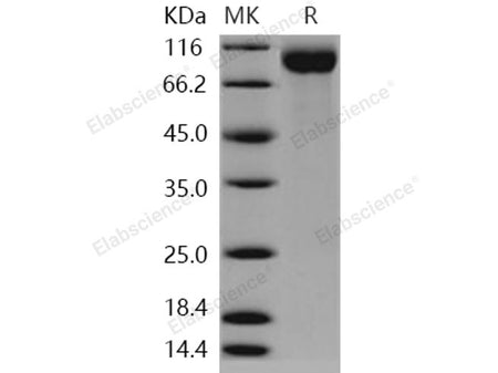 Recombinant Human SIGLEC2/CD22 Protein (aa 176-687, His Tag)