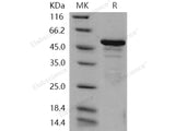 Recombinant Human ANP32A/PHAP1 Protein (His & GST Tag)